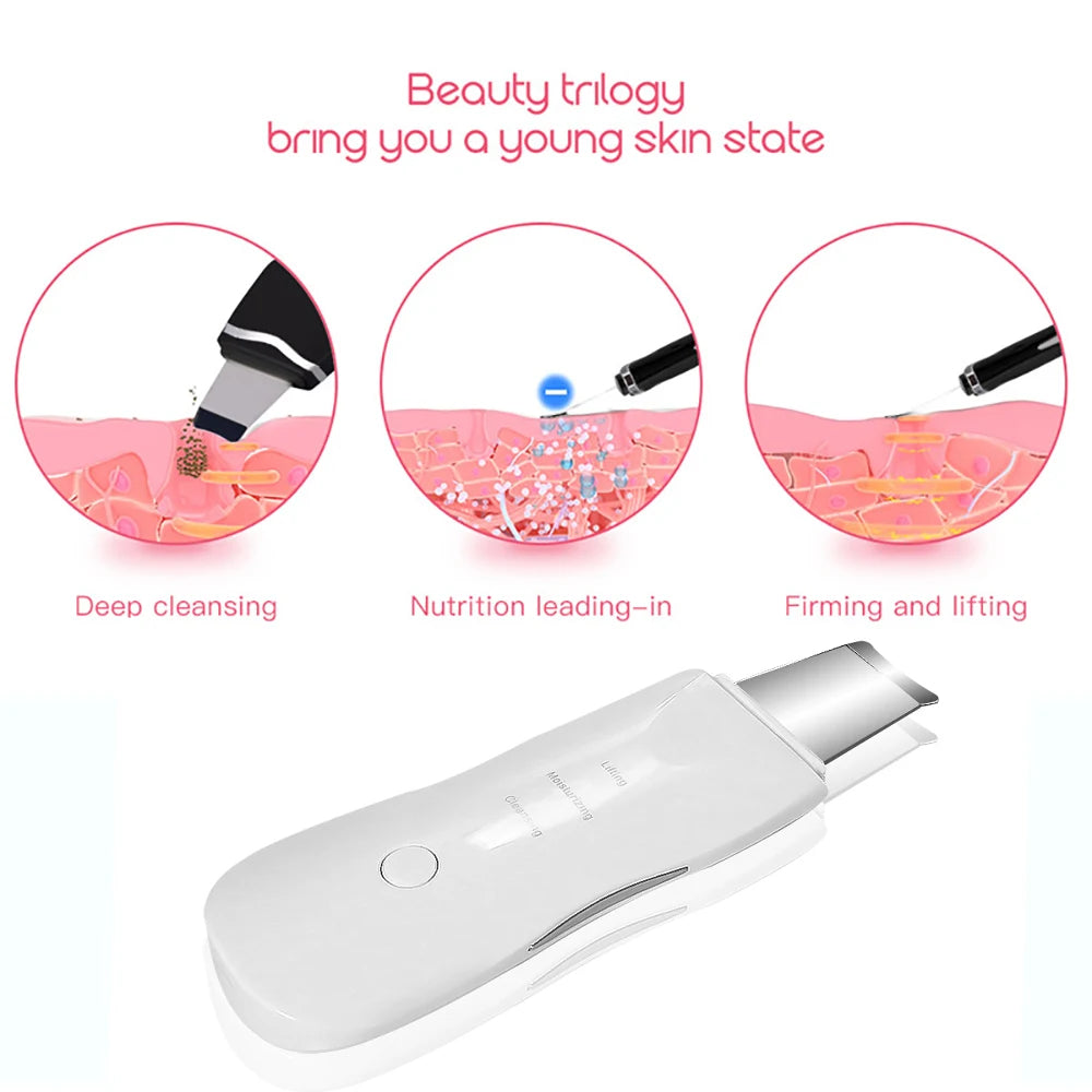 Espátula Ultrasónica Facial – Removedor de Puntos Negros y Masajeador | Tu Belleza & Tu Mascota